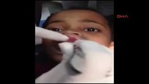 Küçük Kızın Diş Etinden 15 Tane Kurtçuk Çıkarıldı