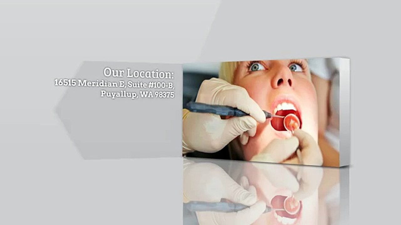 Dentist In Puyallup WA - SK Family Dental - (253) 770-0198