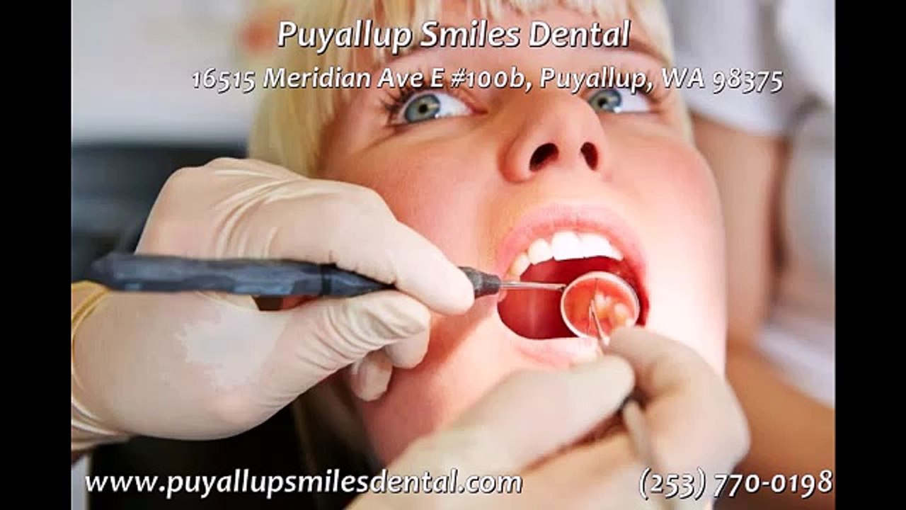 Puyallup WA Dentist - SK Family Dental (253) 770-0198
