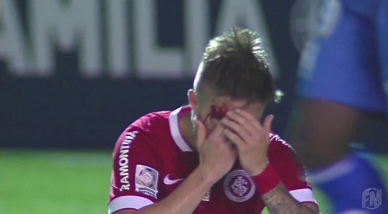 Eduardo Sasha se prend le crampon du gardien en plein tête