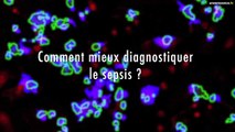 Le sepsis, nouvel enjeu de santé publique ?