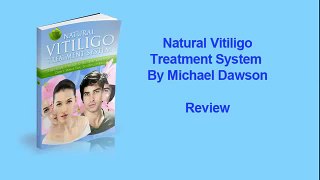 Natural Vitiligo Treatment System Review - Michael Dawson Vitiligo Cure