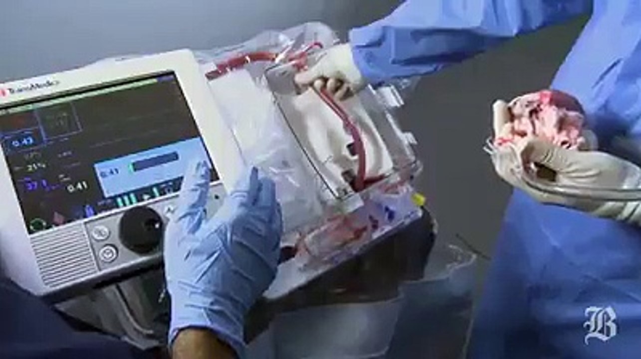 Beating Heart