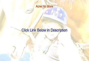 Acne No More Free Review - acne no more roots of health [2015]