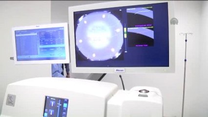 Katarakta Femtosaniye Lazer Teknolojisi ile Müdahale