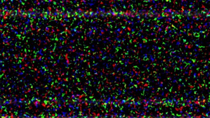 Welcome to Me Official Trailer #1 (2015) - Kristen Wiig, James Marsden Movie HD