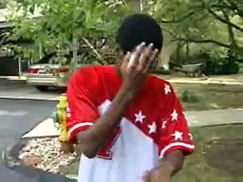 Basketball Player Loses Eye