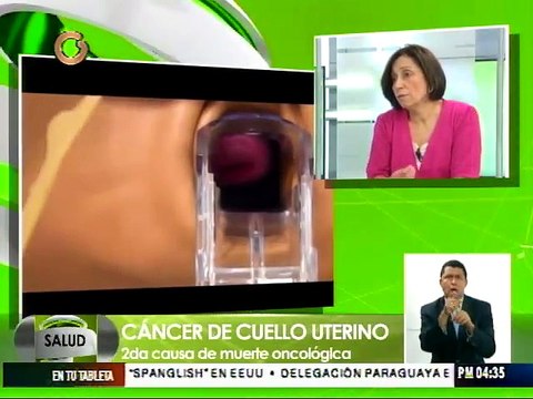 Cáncer de cuello uterino puede sufrirse a partir de los 30 años
