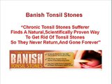 Banish Tonsil Stones - How To Get Rid Of Tonsil Stones Naturally