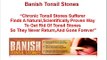Banish Tonsil Stones - How To Get Rid Of Tonsil Stones Naturally