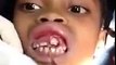 Dentists Removes Maggots From Little Girl's Gums