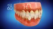 Invisalign Dentist Yucaipa CA - Call (909) 790-2941