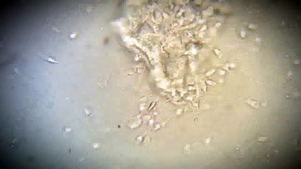 Blood on 1000x Microscope HD 1080p