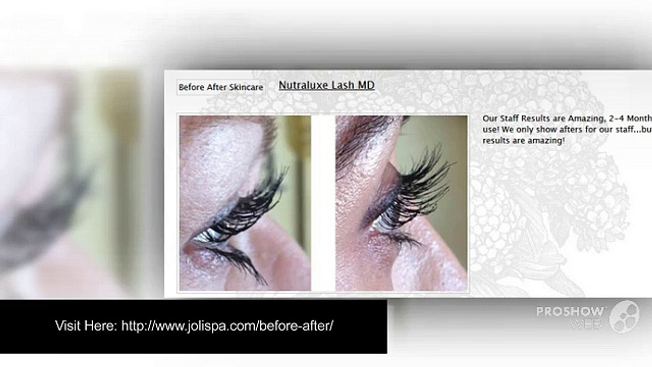Before And After Skincare Treatments By Joli Visage Clinic