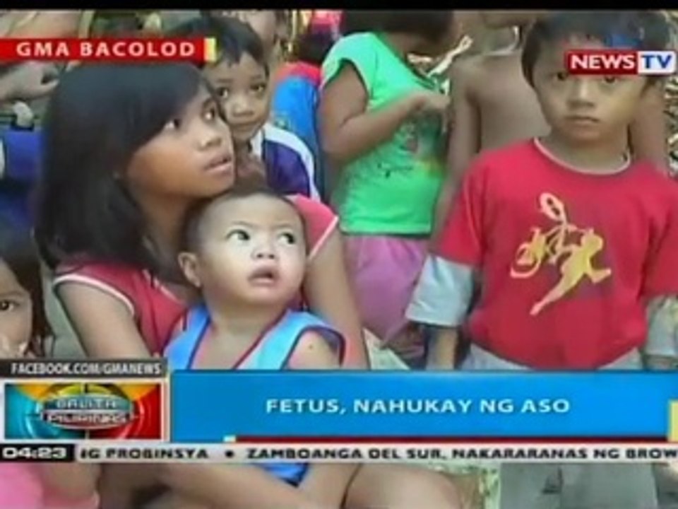 BP: Fetus, nahukay ng aso