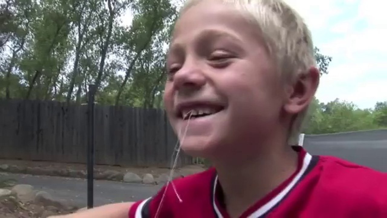 Les Façons les plus Extrêmes d'Enlever une Dent