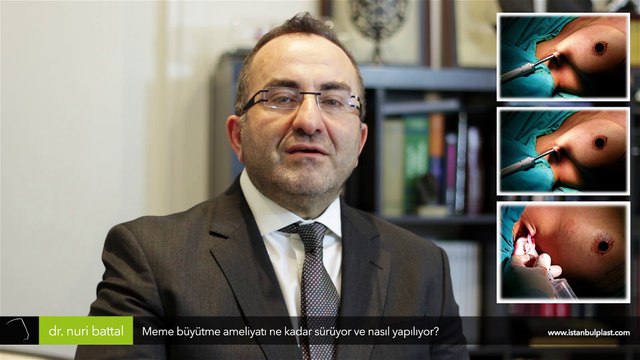 İzsiz göğüs büyütme ameliyatı ne kadar sürüyor ve nasıl yapılıyor? Op. Dr. Nuri Battal