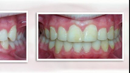 Maxfield Orthodontists Cottonwood Heights 801.263.1333