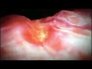 OLUŞUM EVRESİ VE DOĞUM