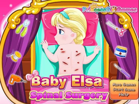 Frozen Baby Elsa Spinal Surgery