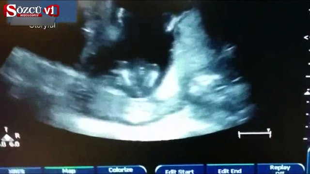 Anne karnında alkış tuttu