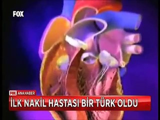 Tıpta devrim duran kalp nakledildi ve ilk nakil hastası bir Türk oldu