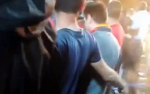 Igor Akinfeev getting hit by a flare last night