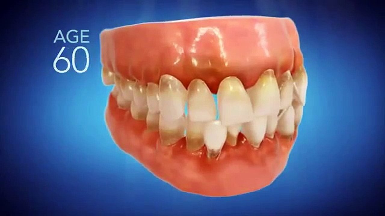 Invisalign Dentist Las Vegas NV - Call (702) 949-2582