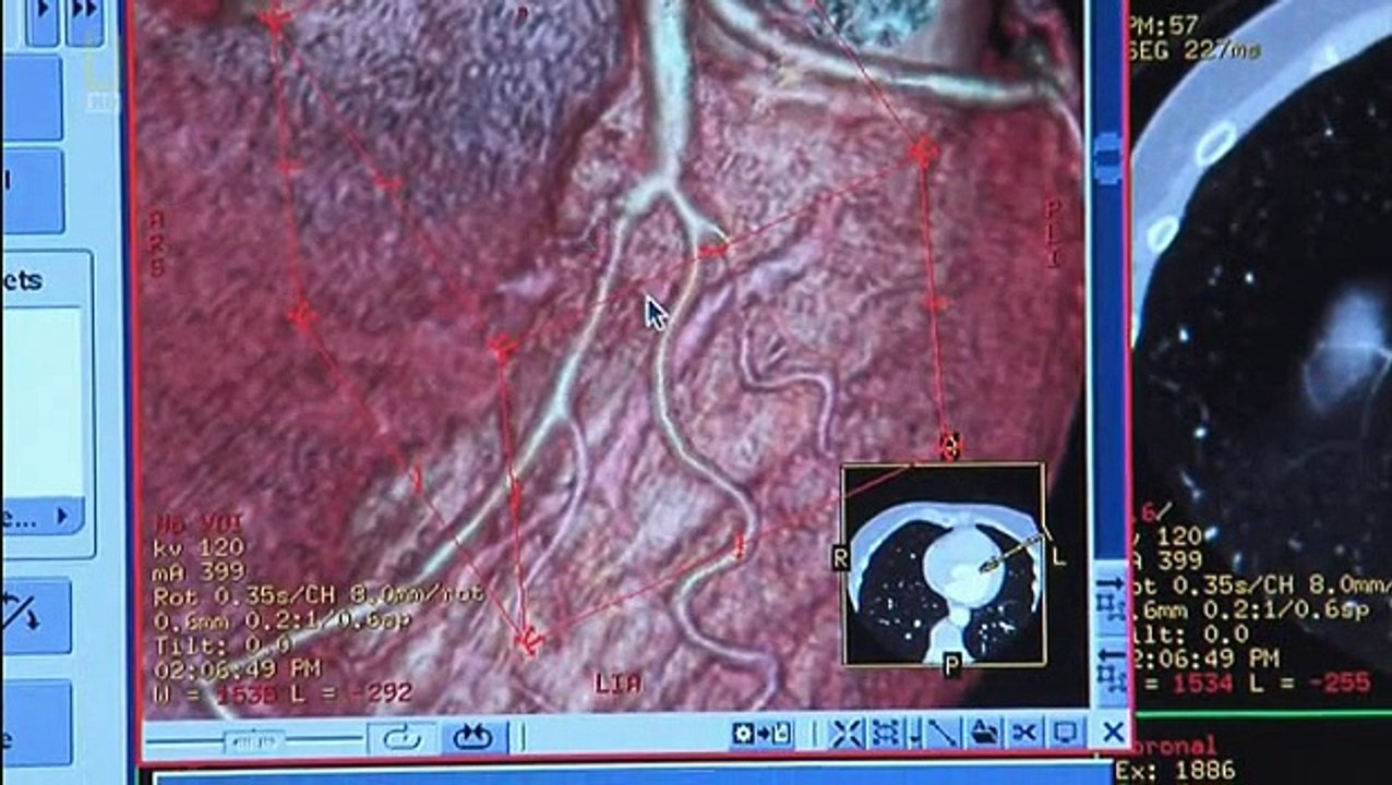 Sekrety Serca Choroby Serca Dokument