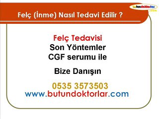 Download Video: 2.görüş için lütfen danışın: 0535 357 35 03, Felç, felç tedavisi, felç tedavi yöntemleri, felç belirtileri, felç çeşitleri, kısmi felç, felç nedenleri, felç neden olur, felç nedir, felç tedavi yöntemleri, felç için şifalı bitkiler, kısmi felç tedavisi, fe