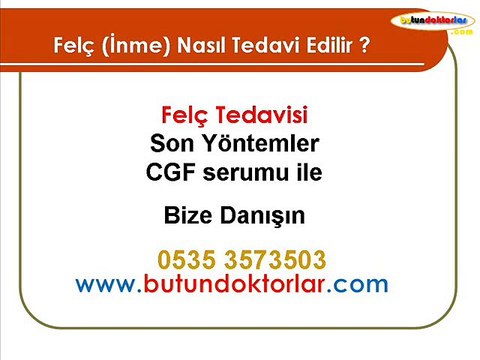 2.görüş için lütfen danışın: 0535 357 35 03, Felç, felç tedavisi, felç tedavi yöntemleri, felç belirtileri, felç çeşitleri, kısmi felç, felç nedenleri, felç neden olur, felç nedir, felç tedavi yöntemleri, felç için şifalı bitkiler, kısmi felç tedavisi, fe
