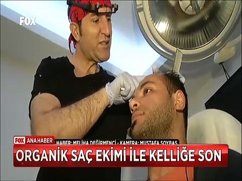 Organik saç ekimi yaptıranlar dökülmeyen ve uzayan saçlar ile kelliğe veda ediyor