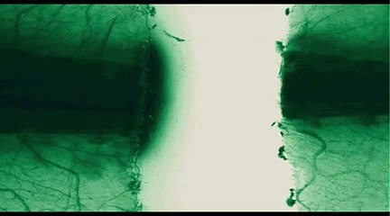 ERRORS OF THE HUMAN BODY - Bande-annonce