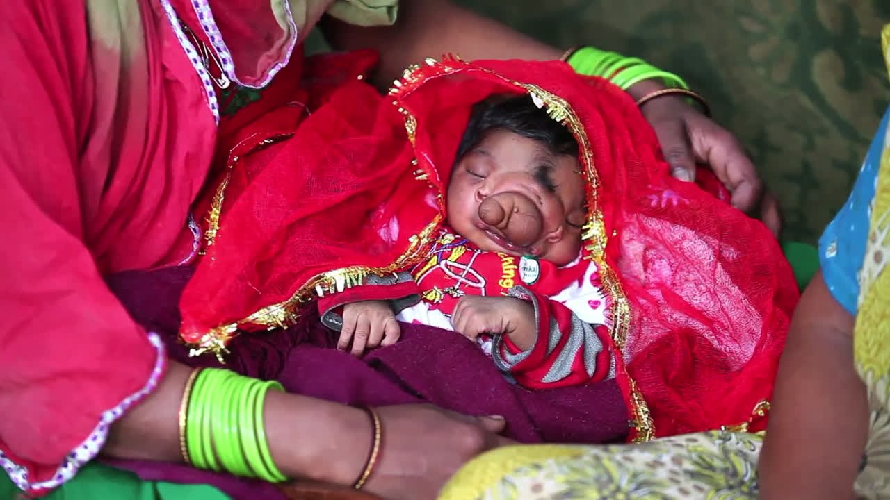Indisches Baby wird mit „Rüssel“ geboren – verehrt als Gottheit