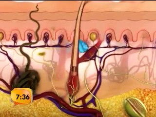 El sebo en la piel tiene una función positiva