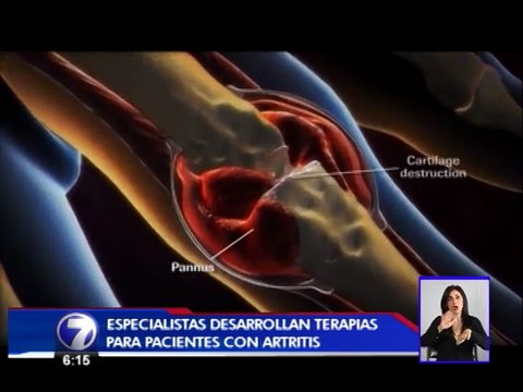 Pacientes con artritis reumatoide cuentan con nuevo tratamiento oral
