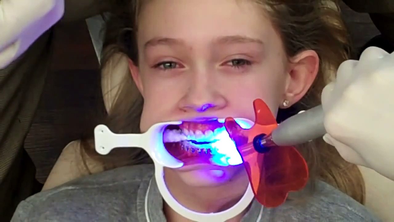 Putting Braces On - See how it is done!
