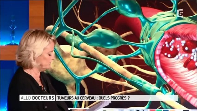 Tumeurs cérébrales