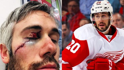 Red Wings' Drew Miller Almost Lost Eye After Taking Skate to Face