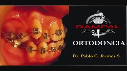 Curso Ortodoncia Cefalometria I: Trazado de las Estructuras Anatómicas