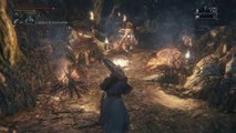 Bloodborne Cooperativo - Capitulo 14: El bosque prohibido