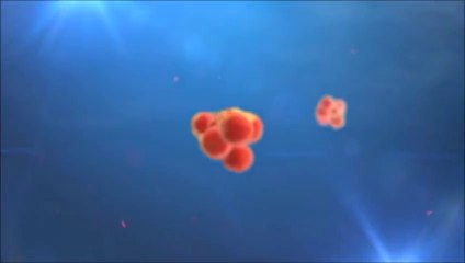 Complicanze impianto pacemaker