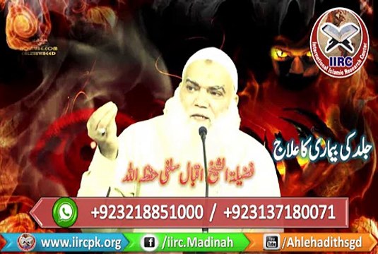 jalid ki bimari ka ilaj By Shaikh Iqbal Salafi Hafizahullah جلد کی بیماری کا علاج از فضیلۃ الشیخ اقبال سلفی حفظہ اللہ