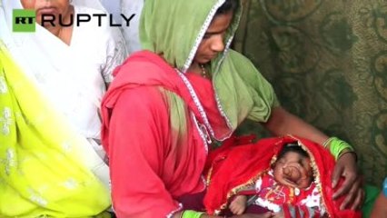 Fil Burunlu Doğan Bebek Tanrı Olarak Saygı Görüyor