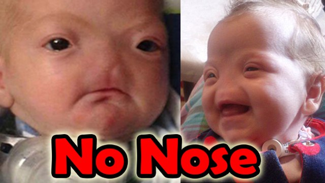 Baby Born WITHOUT NOSE | Shocking!!