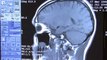 Imagerie médicale et médecine nucléaire : Tout savoir sur l'IRM