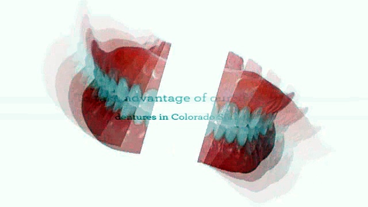 SAME DAY AFFORDABLE DENTURES IN COLORADO SPRINGS