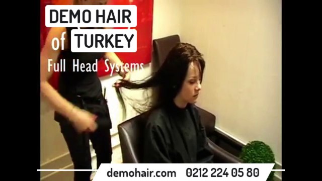 Saç dökülmesi sonucu Protez saç uygulaması. bayan uzun saç