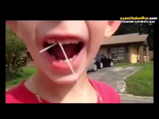 Onlarda / Bizde Diş Çekme