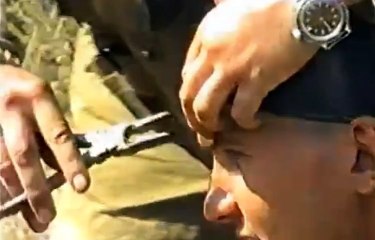 이마에 총알이 박히고도 살아남은 러시아인